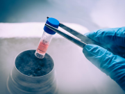 Know About The Stem Cell? stem cells