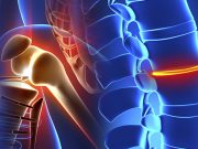 Find Best Orthopedics in Hyderabad Best Orthopedics in Hyderabad