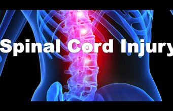 What is spinal cord injury? Common types of back injuries and how can you prevent? what is spinal chord injury
