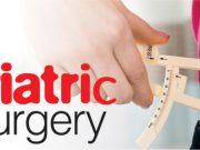 Bariatric Surgery: Helps to reduce extreme weight Bariatric Surgery