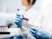 What Kind Of Tests Does A Hematologist Do? Kind Of Tests Does A Hematologist Do
