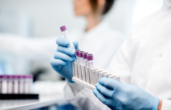 What Kind Of Tests Does A Hematologist Do? Kind Of Tests Does A Hematologist Do