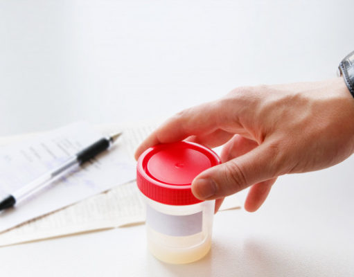 What Causes Male Infertility and How to Cure It? What Causes Male Infertility and How to Cure It? | Dose Pharmacy