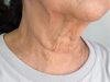 9 Simple Ways for a Smooth and Youthful Neck Smooth and Youthful Neck