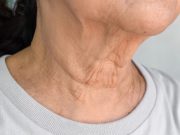 9 Simple Ways for a Smooth and Youthful Neck Smooth and Youthful Neck