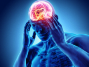 Chronic Migraine Diagnosis and Treatment Migraine Diagnosis and Treatment
