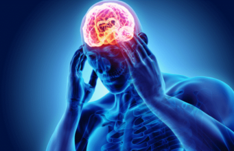Chronic Migraine Diagnosis and Treatment Migraine Diagnosis and Treatment