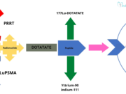 Role of PRRT Therapy in Neuroendocrine Tumor PRRT Therapy