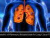 The Benefits of Pulmonary Rehabilitation for Lung Cancer Patients The Benefits of Pulmonary Rehabilitation for Lung Cancer Patients