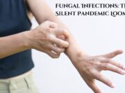 Fungal Infections: The Silent Pandemic Looming? Fungal Infections The Silent Pandemic Looming
