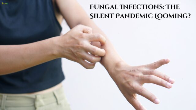 Fungal Infections The Silent Pandemic Looming